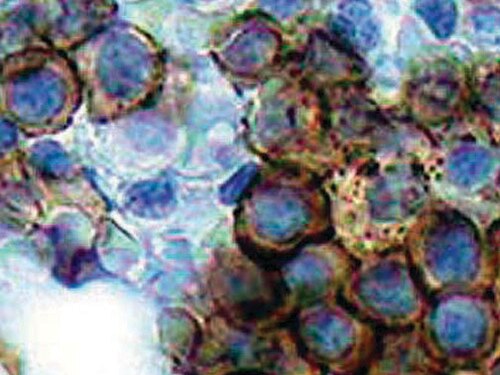IHC of Spectrin on an FFPE Bone Marrow Tissue